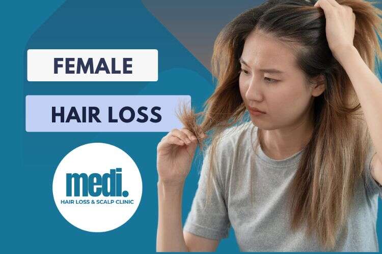 Female Hair Loss - Medi Hair Loss Clinic Ottawa