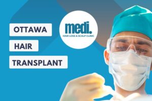 Ottawa Hair Transplant Surgery & the Alternatives