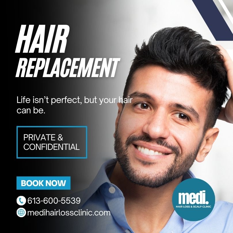 air Replacement Ottawa at Medi Hair Loss Clinic