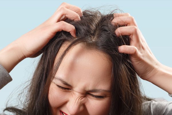 Scalp problem - Itchy Scalp pain -Scalp hurts -Treatment at Medi Hair Loss and Scalp Clinic