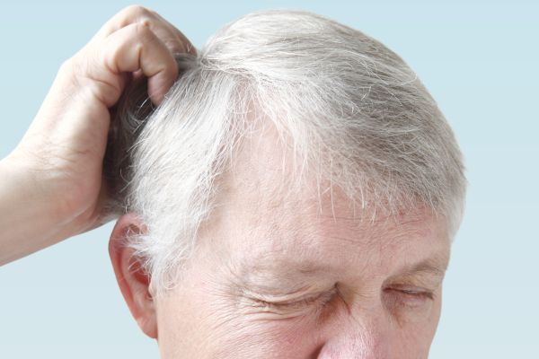 Scalp problems - scalp pain treatment at Medi Hair Loss and Scalp Clinic