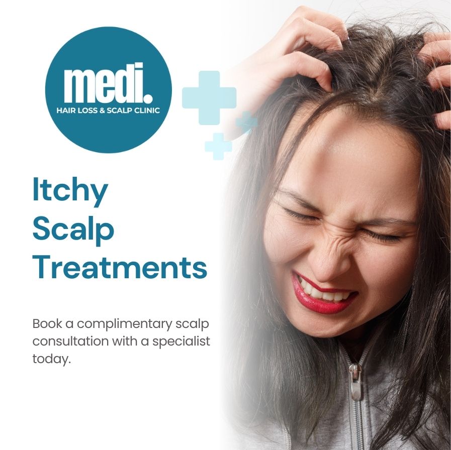 Itchy Scalp Treatments Near me - Medi Hair Loss & Scalp Clinics