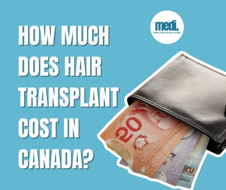 How much does hair transplant cost in Canada