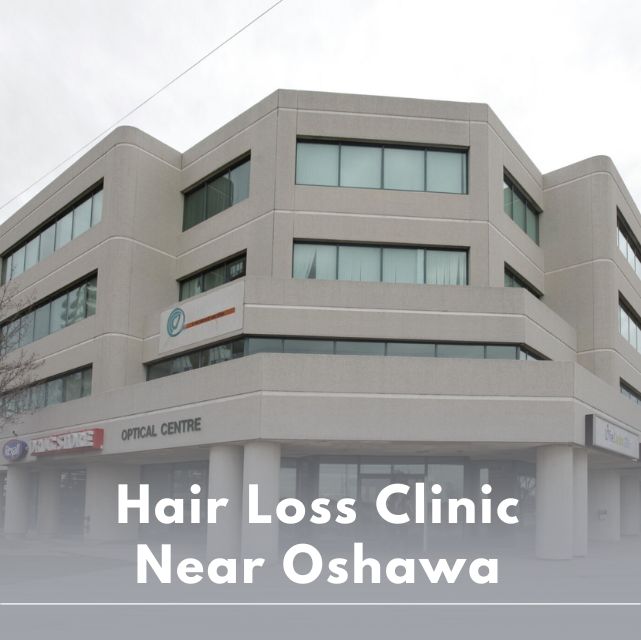 Hair Loss Clinic near Oshawa ON - Medi Hair Loss & Scalp Clinic