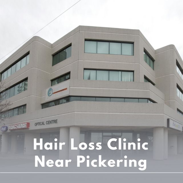 Hair Loss Clinic near Pickering, ON