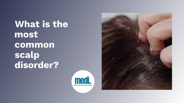 What is the most common scalp disorder - Medi Hair Loss & Scalp Clinic Toronto & Ottawa