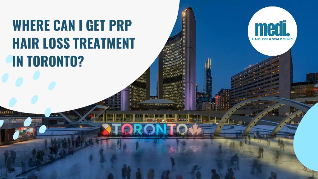 Where can I get PRP hair loss treatment in Toronto - Medi Hair Loss & Scalp Clinic