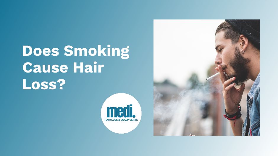 Does smoking cause hair loss - Medi Hair Loss & Scalp Clinic