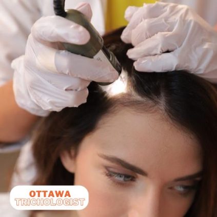 Ottawa Trichologist -Certified Trichologist Ottawa